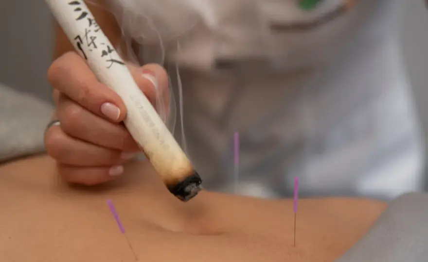 Moksa, czyli moksoterapia - jak działa i kiedy ma sens?