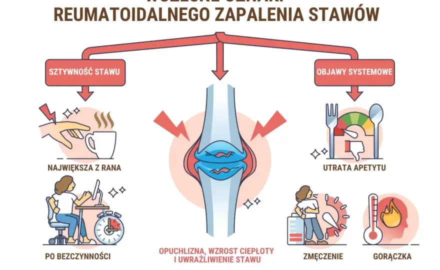 Wirusowe zapalenie stawów - jak je rozpoznać i wrócić do ruchu