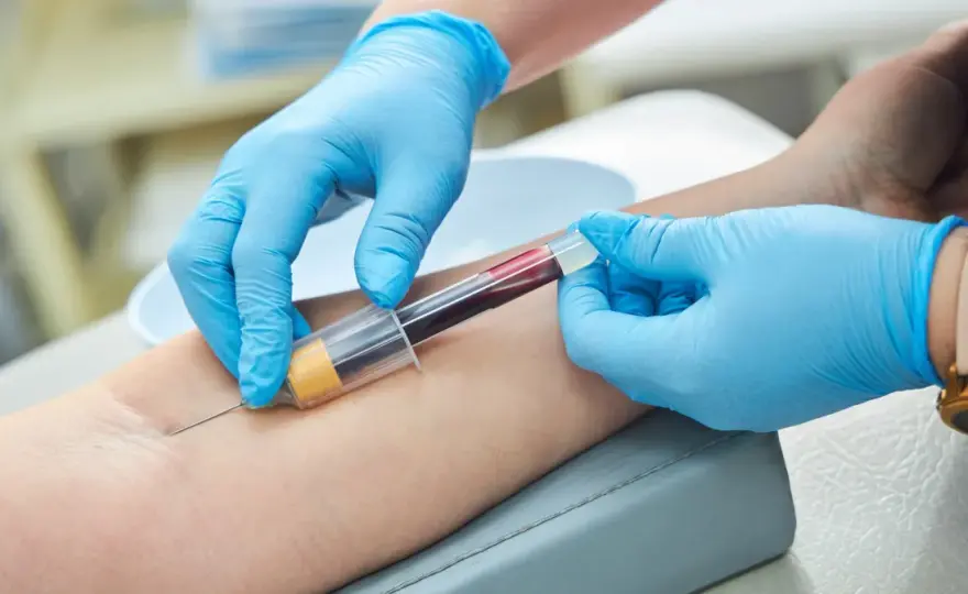 Jak szybko obniżyć próby wątrobowe? Co naprawdę działa