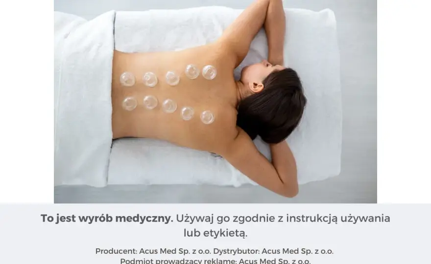 Bańki na kaszel - Gdzie stawiać i jak unikać błędów?